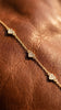 The interval bracelet